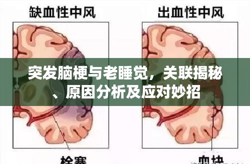 突发脑梗与老睡觉,关联揭秘、原因分析及应对妙招